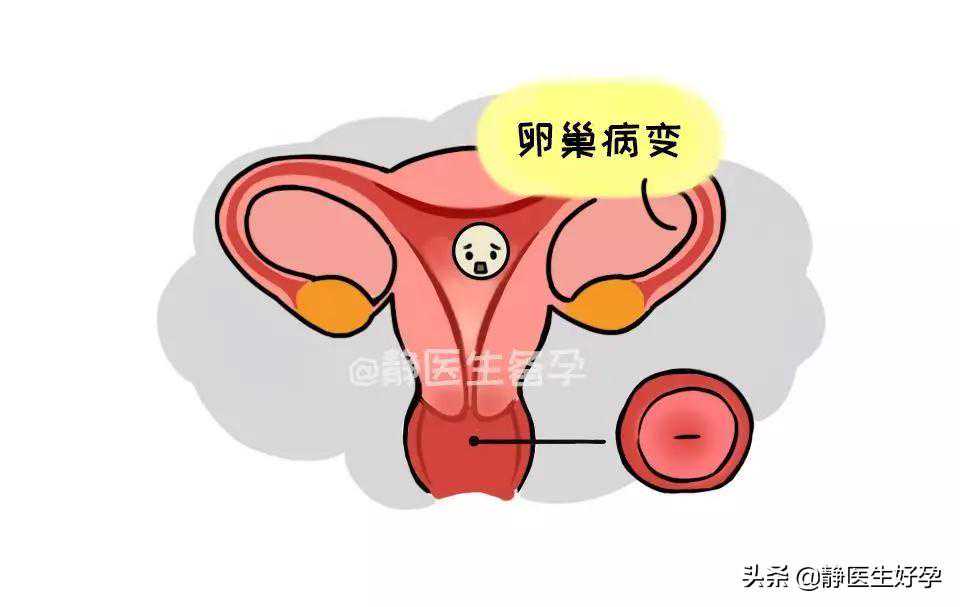 香港7周验血微信,精心备孕8个月没怀上医生说我遭遇了排卵障碍，该怎么办啊